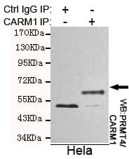 Monoclonal Mouse anti-Human PRMT4 / CARM1 Antibody (WB)