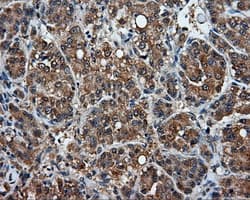 HMRF1L / MTRF1L Antibody (clone OTI1D11)