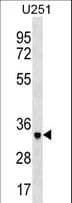 NPL / C112 Antibody (aa49-77)