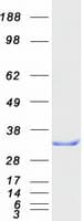 Human RANBP1 Protein (Recombinant Myc-DDK (Flag))