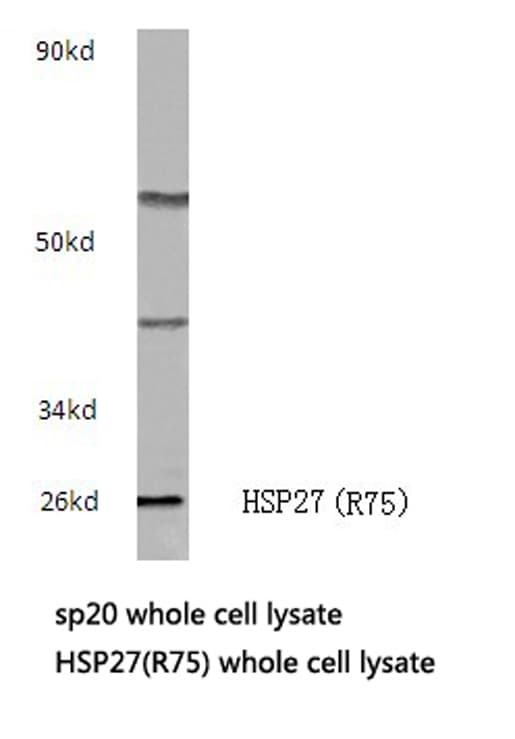HSPB1 / HSP27 Antibody (Arg75)