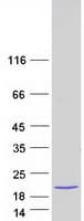 Human MB / Myoglobin Protein (Recombinant Myc-DDK (Flag))