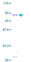 Human TXNRD2 Protein (Recombinant GST)