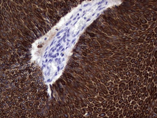 KRT19 / CK19 / Cytokeratin 19 Antibody (aa240-390, clone OTI1C11)