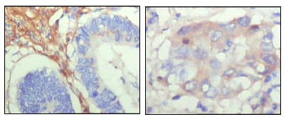 FBLN5 / Fibulin 5 Antibody (clone 1G6A4)