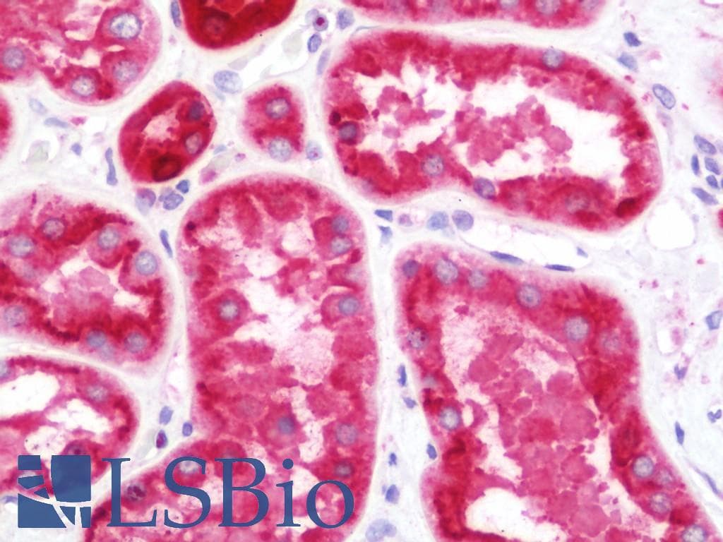 IHC-plus™ SERPINF2 / Alpha-2-Antiplasmin Antibody (aa188-453)