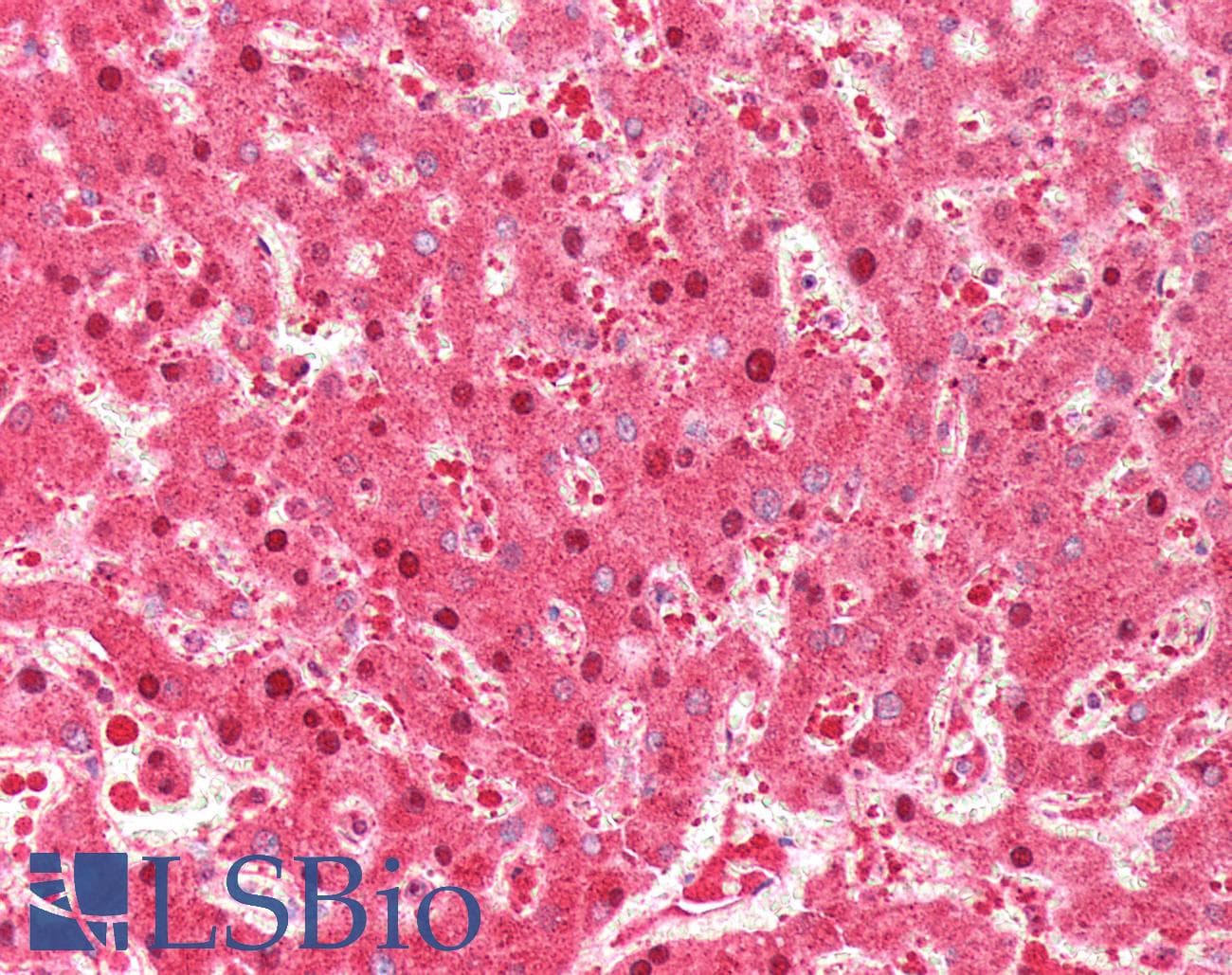 IHC-plus™ Polyclonal Rabbit anti-Human CRBN / Cereblon Antibody (IHC, WB)