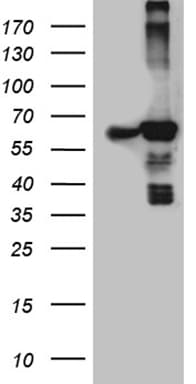 ACAD9 Antibody (clone OTI1D4, Carrier-free)
