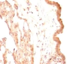 GPC3 / Glypican 3 Antibody (clone SGPN3-1)