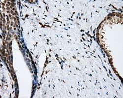 NIT2 Antibody (clone OTI6H7)