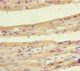 Polyclonal Rabbit anti-Human PDK4 Antibody (IHC)