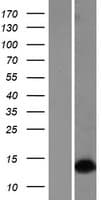 DLX1 Protein (Over-Expression Lysate Myc-DDK (Flag))
