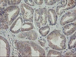 NNA1 / AGTPBP1 Antibody (clone OTI9A3)