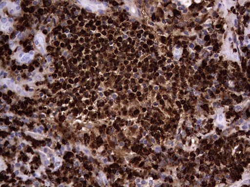 Monoclonal Mouse anti-Human CEACAM5 / CD66e Antibody (clone OTI3D8, aa35-680, IHC, WB)