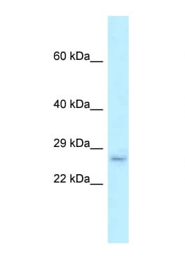 EVA1B Antibody (aa101-150)
