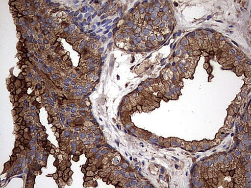 KRT7 / CK7 / Cytokeratin 7 Antibody (clone OTI2A2)