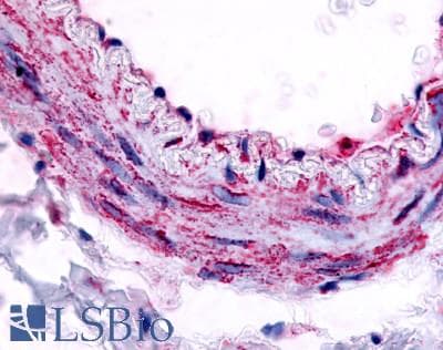 PathPlus™ Polyclonal Rabbit anti-Human ADRA1B / Adrenoceptor alpha 1B Antibody (Cytoplasmic Domain, IHC)