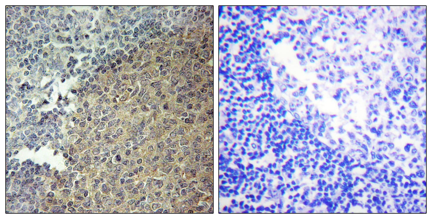 Polyclonal Rabbit anti-Human BLNK Antibody (aa62-111, IHC, WB)