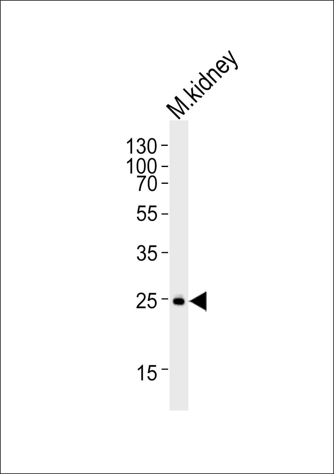 SNAI1 / SNAIL-1 Antibody (aa1-30)