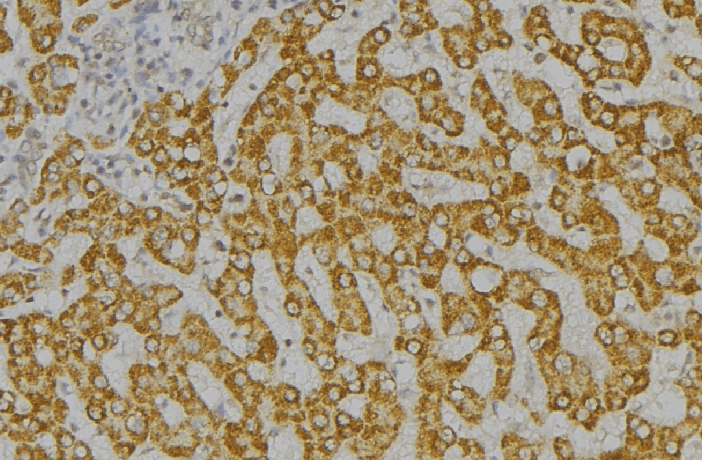 SH2D1A / SAP Antibody