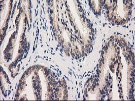 GRHPR / Glyoxylate Reductase Antibody (clone OTI2H4)