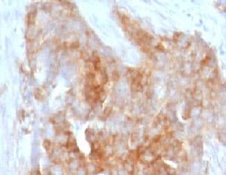 FSCN1 / Fascin Antibody (clone FAN55-1, Azide-free, BSA-free)