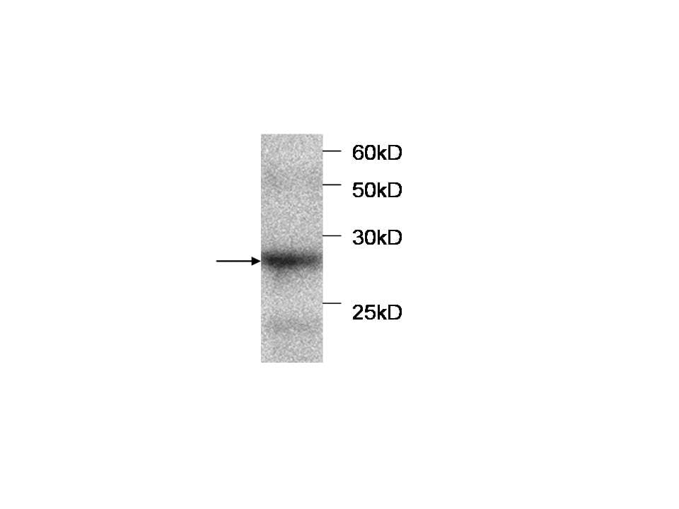 SERPINB4 / SCCA1+2 Antibody