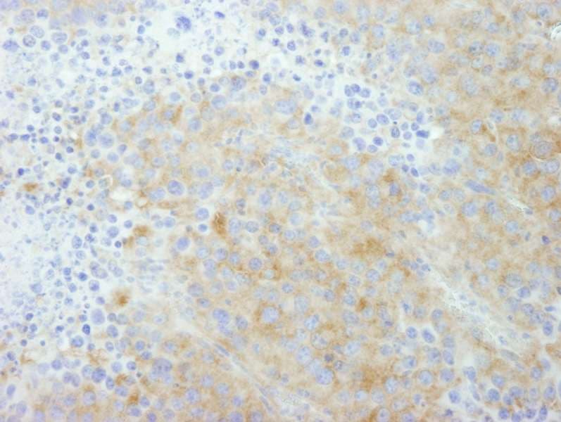 Polyclonal Rabbit anti-Human PTP-PEST / PTPN12 Antibody (aa760-780, IHC, IF)