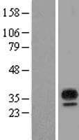 MARCH8 Protein (Over-Expression Lysate Myc-DDK (Flag))