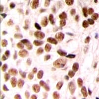 MED23 / SUR2 Antibody (N-Terminus)