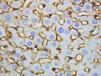 Polyclonal Rabbit anti-Human ANXA5 / Annexin V Antibody (aa88-102, IHC, WB)