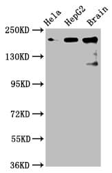 CKAP5 / ch-TOG Antibody