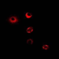 Polyclonal Rabbit anti-Human CPT1A Antibody (IF, WB)