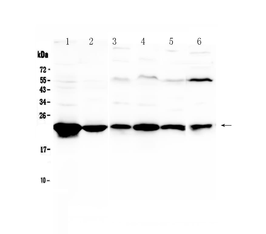 GSTP1 / GST Pi Antibody