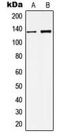 KCNMA1 / BK Antibody (Internal)
