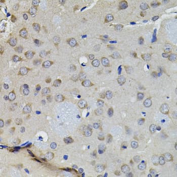Polyclonal Rabbit anti-Human AURKC / Aurora C Antibody (IHC, WB)