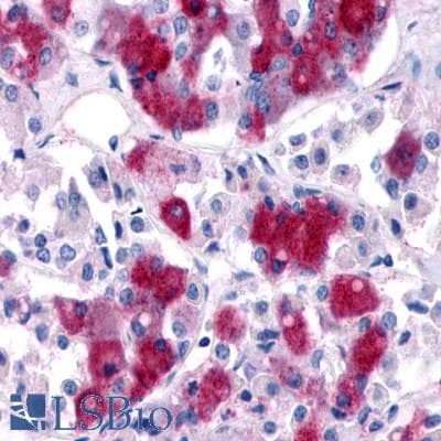 PathPlus™ GPR161 Antibody (N-Terminus)