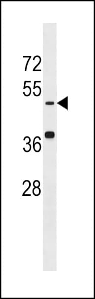 Polyclonal Rabbit anti-Human KREMEN1 / KREMEN-1 Antibody (aa6-37, IHC, WB)