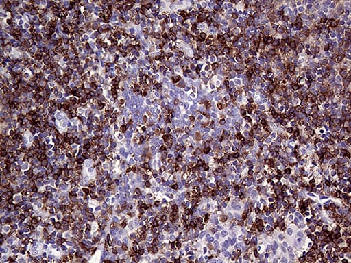 CD79B / CD79 Beta Antibody (clone OTI9H8)