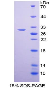Mouse GATA1 Protein (Recombinant His-T7)