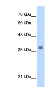 LDB1 / CLIM2 Antibody (aa303-352)