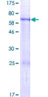Human ENPP6 Protein (Recombinant GST)