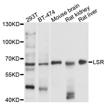 IHC-plus™ LSR / LISCH7 Antibody