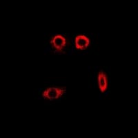 Polyclonal Rabbit anti-Human PYGL Antibody (IHC, IF, WB)