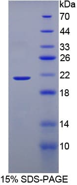Mouse BRD8 Protein (Recombinant His-T7)