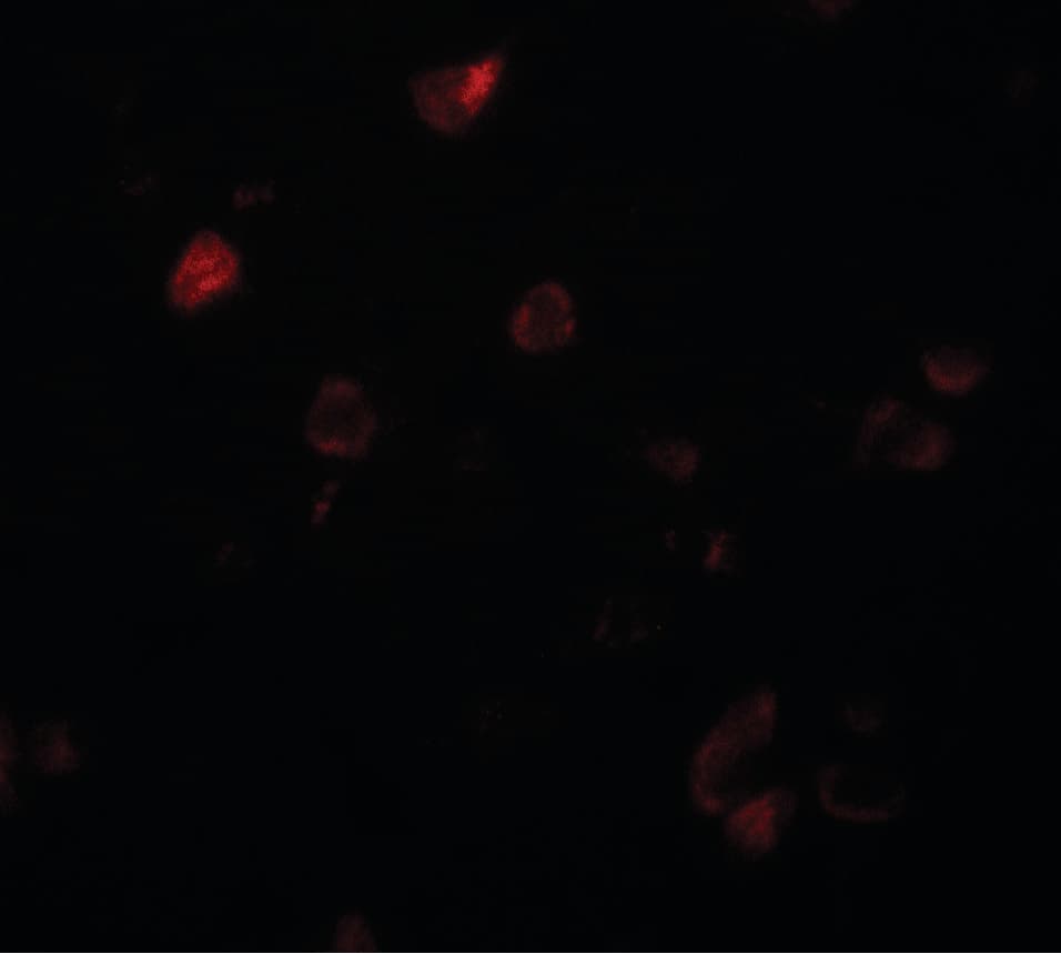 IHC-plus™ CCDC22 Antibody