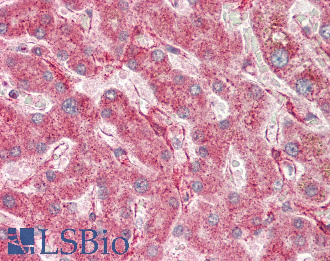 IHC-plus™ Polyclonal Rabbit anti-Human VDAC1 / PORIN Antibody (aa1-30, IHC, WB)