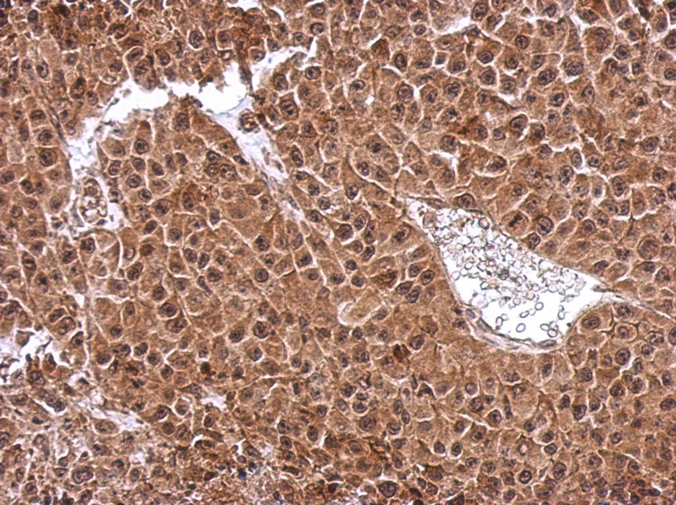 DENR / Density Regulated Antibody