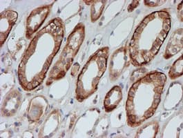 Monoclonal Mouse anti-Human FXYD3 Antibody (clone OTI1E8, IHC, IF, WB)