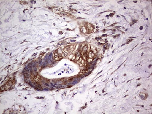 PROCR / EPCR Antibody (aa1-210, clone OTI13E1)